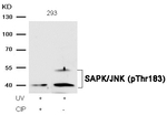 Phospho-JNK1 (Thr183) Antibody in Western Blot (WB)