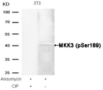 Phospho-MEK3 (Ser189) Antibody in Western Blot (WB)