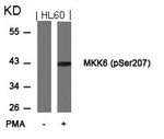 Phospho-MEK6 (Ser207) Antibody in Western Blot (WB)