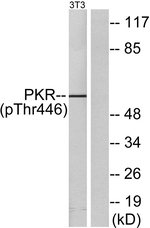 Phospho-PKR (Thr446) Polyclonal Antibody