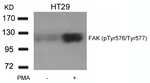 Phospho-FAK (Tyr576, Tyr577) Antibody in Western Blot (WB)