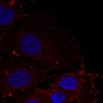 Phospho-Paxillin (Tyr88) Antibody in Immunocytochemistry (ICC/IF)