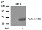 Phospho-Paxillin (Tyr88) Antibody in Western Blot (WB)