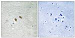 Phospho-c-Raf (Thr269) Antibody in Immunohistochemistry (Paraffin) (IHC (P))