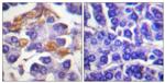 Phospho-c-Raf (Tyr341) Antibody in Immunohistochemistry (Paraffin) (IHC (P))