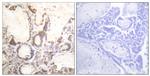 Phospho-RACGAP1 (Ser387) Antibody in Immunohistochemistry (Paraffin) (IHC (P))