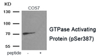 Phospho-RACGAP1 (Ser387) Antibody in Western Blot (WB)