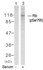 Phospho-Rb (Ser795) Antibody in Western Blot (WB)