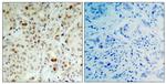Phospho-Rb (Ser807) Polyclonal Antibody