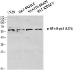 Phospho-NFkB p65 (Ser276) Antibody in Western Blot (WB)