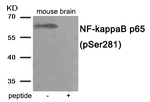 Phospho-NFkB p65 (Ser281) Antibody in Western Blot (WB)