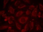 Phospho-NFkB p65 (Ser468) Antibody in Immunocytochemistry (ICC/IF)