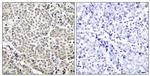 Phospho-NFkB p65 (Ser529) Antibody in Immunohistochemistry (Paraffin) (IHC (P))