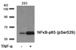 Phospho-NFkB p65 (Ser529) Antibody in Western Blot (WB)