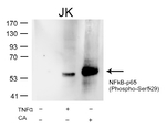 Phospho-NFkB p65 (Ser529) Antibody in Western Blot (WB)