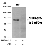 Phospho-NFkB p65 (Ser529) Antibody in Western Blot (WB)