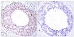 Phospho-NFkB p65 (Thr254) Antibody in Immunohistochemistry (Paraffin) (IHC (P))