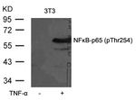 Phospho-NFkB p65 (Thr254) Antibody in Western Blot (WB)