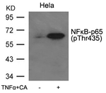 Phospho-NFkB p65 (Thr435) Antibody in Western Blot (WB)
