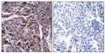 Phospho-NFkB p65 (Thr505) Antibody in Immunohistochemistry (Paraffin) (IHC (P))