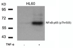 Phospho-NFkB p65 (Thr505) Antibody in Western Blot (WB)