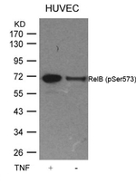 Phospho-RelB (Ser573) Antibody in Western Blot (WB)