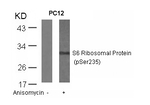 Phospho-S6 (Ser235) Antibody in Western Blot (WB)