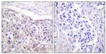 Phospho-RSK1 (Thr573) Antibody in Immunohistochemistry (Paraffin) (IHC (P))