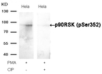 Phospho-RSK1 (Ser352) Antibody in Western Blot (WB)