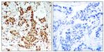 Phospho-RSK1 (Thr348) Antibody in Immunohistochemistry (Paraffin) (IHC (P))