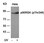 Phospho-RSK1 (Thr348) Antibody in Western Blot (WB)