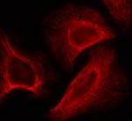 Phospho-p70 S6 Kinase (Ser424) Antibody in Immunocytochemistry (ICC/IF)