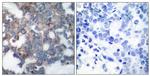 Phospho-p70 S6 Kinase (Ser424) Antibody in Immunohistochemistry (Paraffin) (IHC (P))