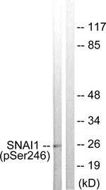 Phospho-SNAIL (Ser246) Antibody in Western Blot (WB)