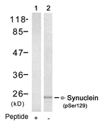 Phospho-alpha Synuclein (Ser129) Polyclonal Antibody