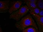 Phospho-alpha Synuclein (Tyr125) Antibody in Immunocytochemistry (ICC/IF)