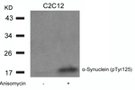 Phospho-alpha Synuclein (Tyr125) Antibody in Western Blot (WB)