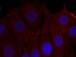 Phospho-alpha Synuclein (Tyr133) Antibody in Immunocytochemistry (ICC/IF)