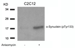 Phospho-alpha Synuclein (Tyr133) Antibody in Western Blot (WB)