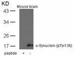 Phospho-alpha Synuclein (Tyr136) Antibody in Western Blot (WB)