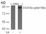 Phospho-STAT5 alpha (Ser780) Antibody in Western Blot (WB)