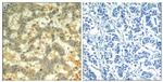 Phospho-Syk (Tyr323) Antibody in Immunohistochemistry (Paraffin) (IHC (P))
