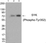 Phospho-Syk (Tyr352) Polyclonal Antibody