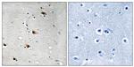 Phospho-TCF3 (Thr355) Polyclonal Antibody