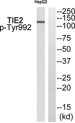 Phospho-TEK (Tyr992) Antibody in Western Blot (WB)