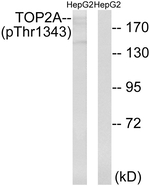 Phospho-TOP2A (Thr1343) Antibody in Western Blot (WB)