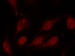 Phospho-p53 (Ser315) Antibody in Immunocytochemistry (ICC/IF)