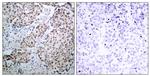 Phospho-p53 (Ser315) Antibody in Immunohistochemistry (Paraffin) (IHC (P))