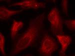 Phospho-p53 (Ser33) Antibody in Immunocytochemistry (ICC/IF)