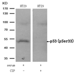 Phospho-p53 (Ser33) Antibody in Western Blot (WB)